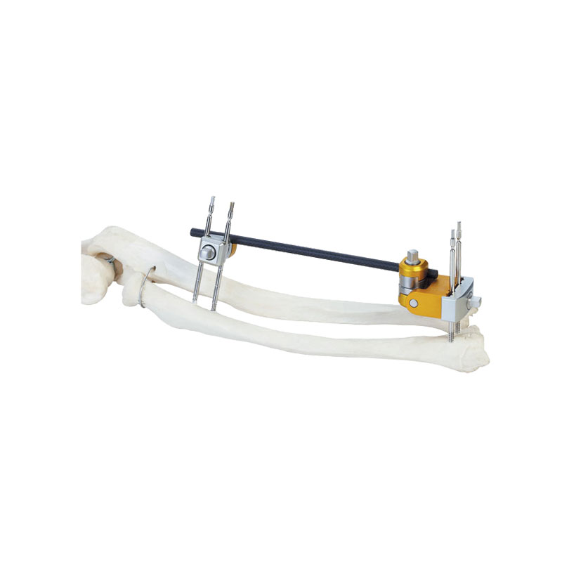 Distal radius frame