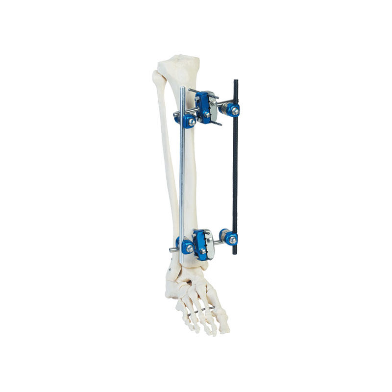 Tibial diaphysis symmetrical frame